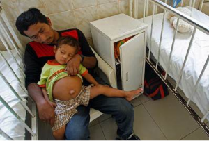 Doctors to Operate on Boy With Fetus in Stomach