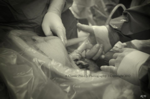 Baby Grabs Doctor's Finger While Inside Mother's Womb